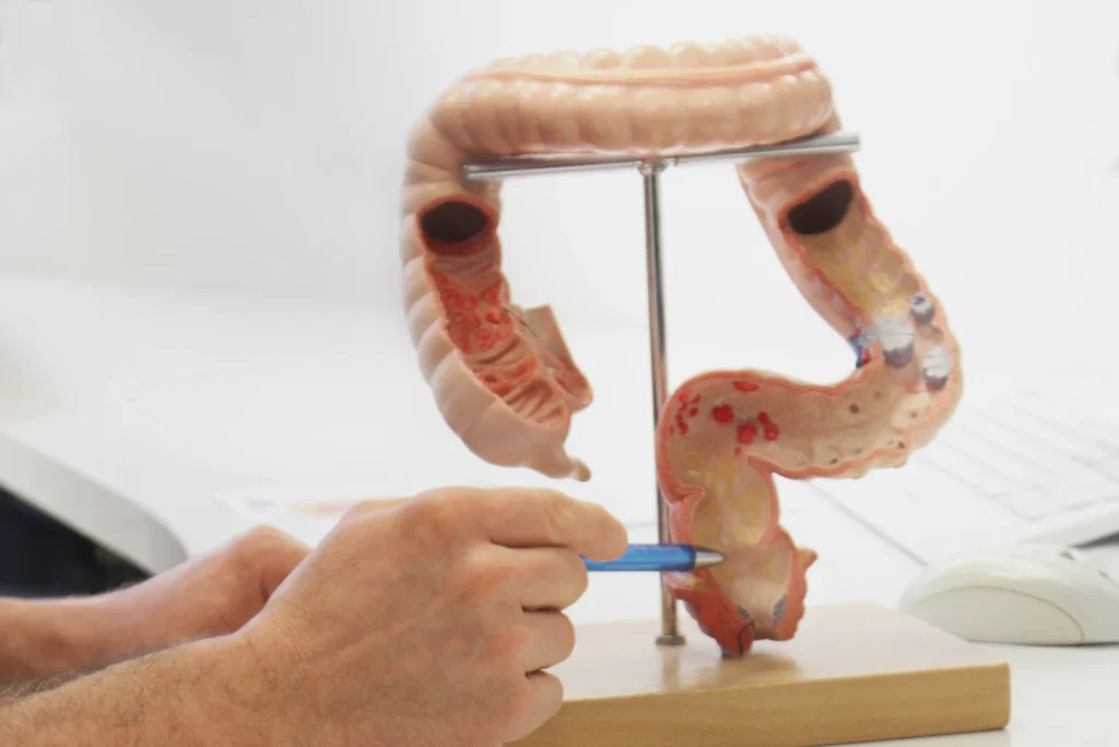 Ein medizinisches Modell eines Darms, dass gerade von einem Arzt erläutert wird, der mit den Fingern auf bestimmte Stellen aufmerksam macht während seiner Erklärung.