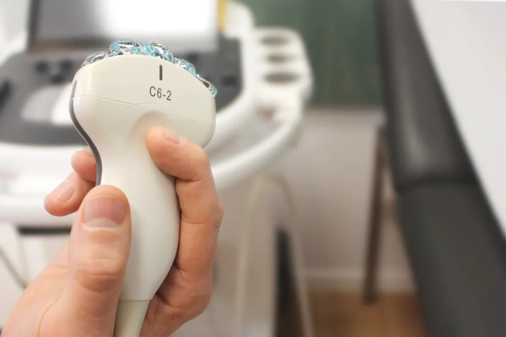 Die Hand eines Arztes hält den Schallkopf eines Ultraschallgerätes bei einer Untersuchung.